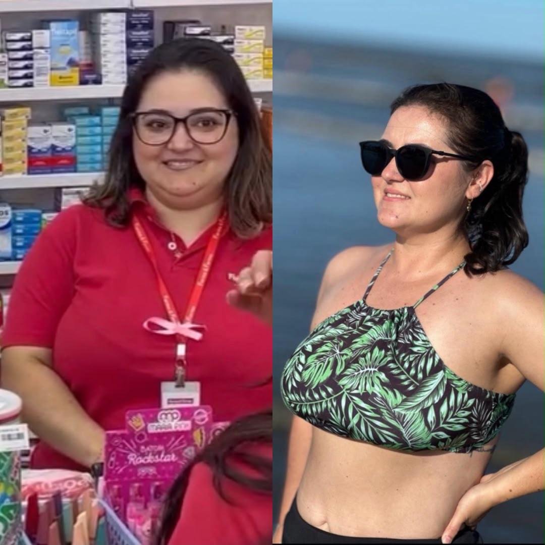 Evolução de paciente — antes e depois