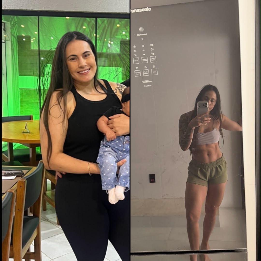 Evolução de paciente — antes e depois