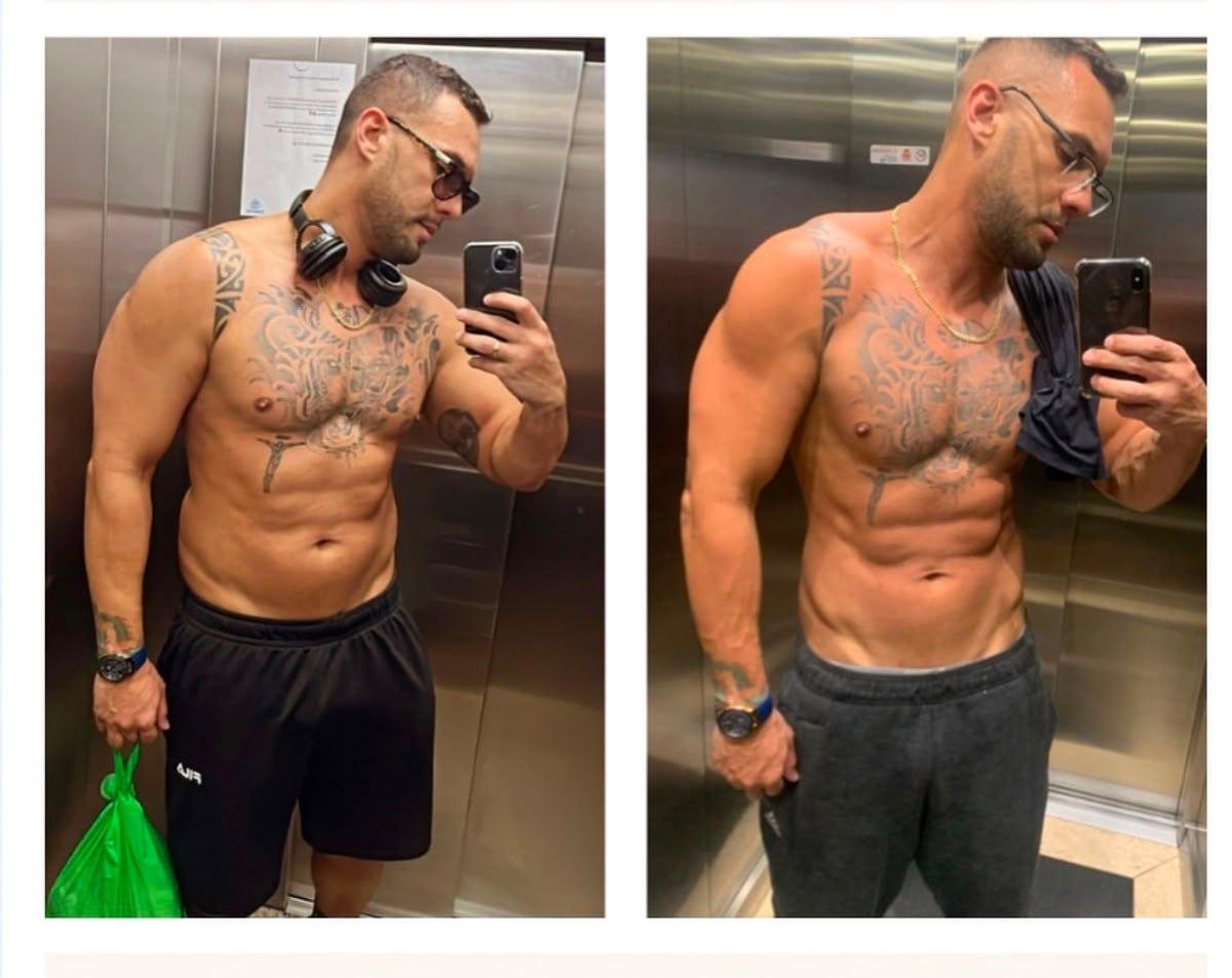 Evolução de paciente — antes e depois